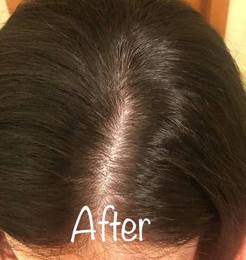 after image of the same reviewer with a clean and clear scalp