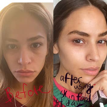 reviewer before and after photos showing their under-eye area looking much brighter after using the skin cream