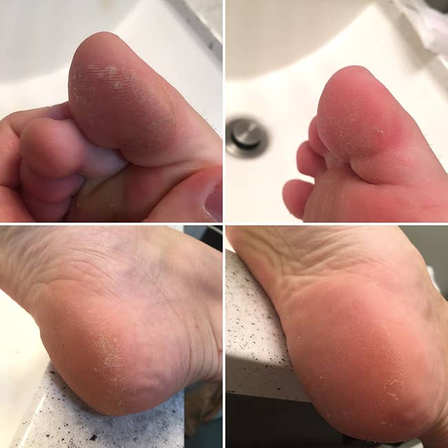 Reviewer's results after using pumice stone