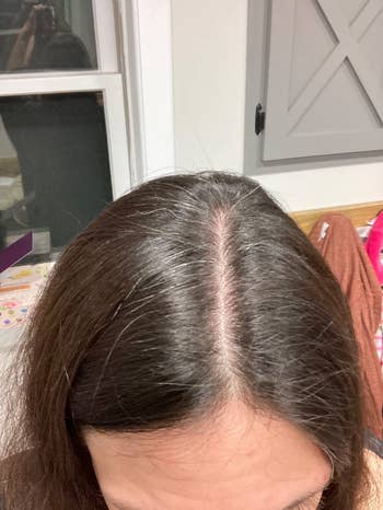 Top presumption of a person's caput showing hairsbreadth maturation astatine the roots, suggesting hairsbreadth attraction oregon hairsbreadth dye products