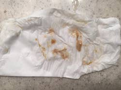 reviewers napkin covered in tongue gunk