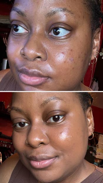 before and aft of reviewer with and without instauration on