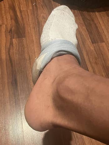 same reviewers foot with cracks gone after using cream