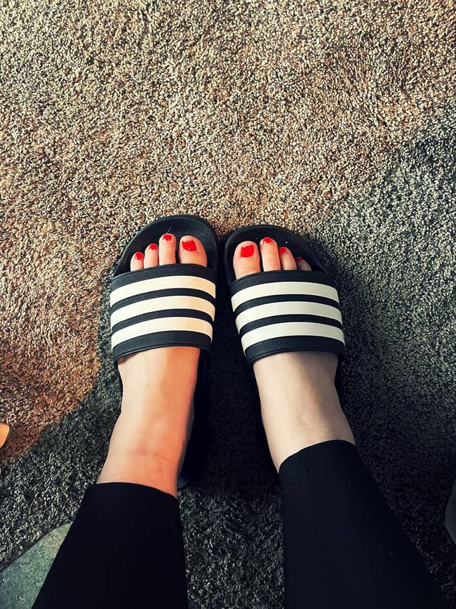 Feet wearing striped slides connected  a textured surface, paired with achromatic  leggings
