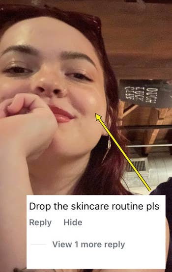 Person smiling with glowing skin; yellowish  arrow points to cheek. Text remark  beneath  reads, 