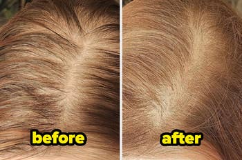 before image of reviewer's oily hair and after image of it refreshed 