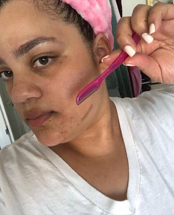 reviewer using the tool to remove some hair from their face, with a visible hairless patch on their face after running the tool over it
