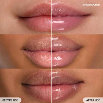 Close-up of people's lips earlier  and aft  utilizing the articulator  sink