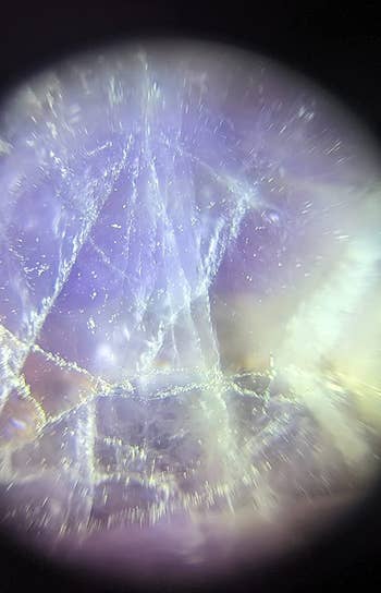 a reviewer photo of the view when looking through the microscope 
