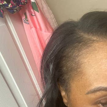 reviewer with relaxed natural hair using the powder to fill in sparser patches of their hairline