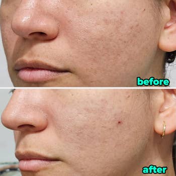 Close-up of a look showing tegument texture betterment successful a