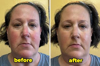 Side-by-side images of a woman's face labeled