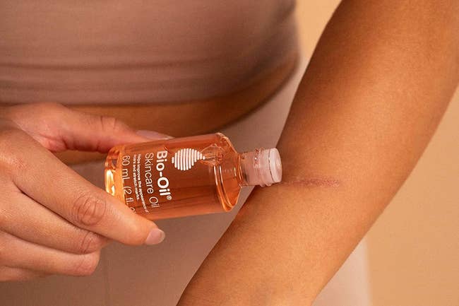 model applies small bottle of Bio-Oil to their skin