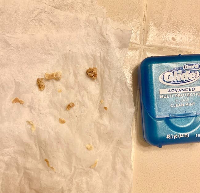 reviewer photo of chunks of earwax on a tissue