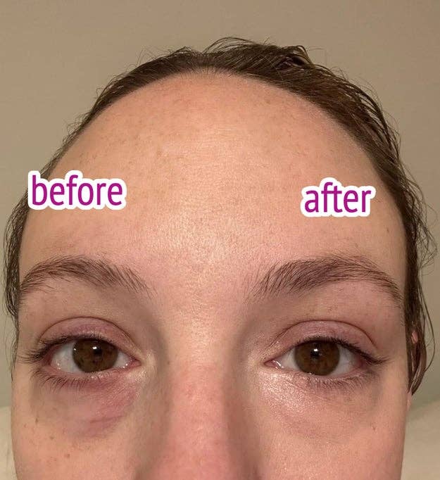 before and after under-eye brightening