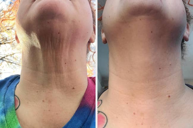 Before and after shots of a person's neck showing skin tightening effects, likely illustrating results from a skincare product