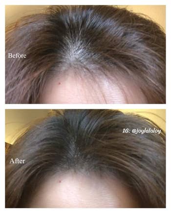 reviewer's before and after showing the powder helped darken their scalp and make their hair look thicker