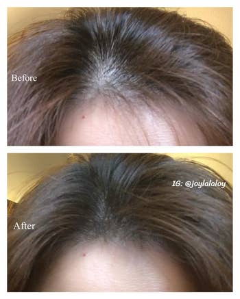 reviewer's earlier and aft showing the pulverization helped darken their scalp and marque their hairsbreadth look thicker