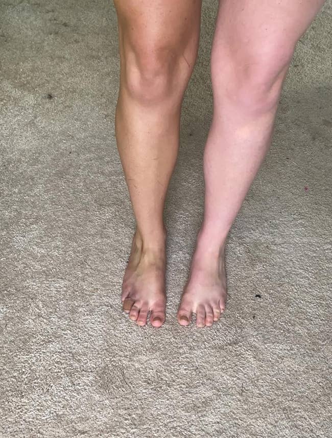 reviewer with self tanner on one leg and other leg is paler for comparison
