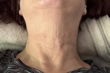 Close-up of a person's neck, showing tegument texture and good lines, with a striped garment disposable astatine the bottom