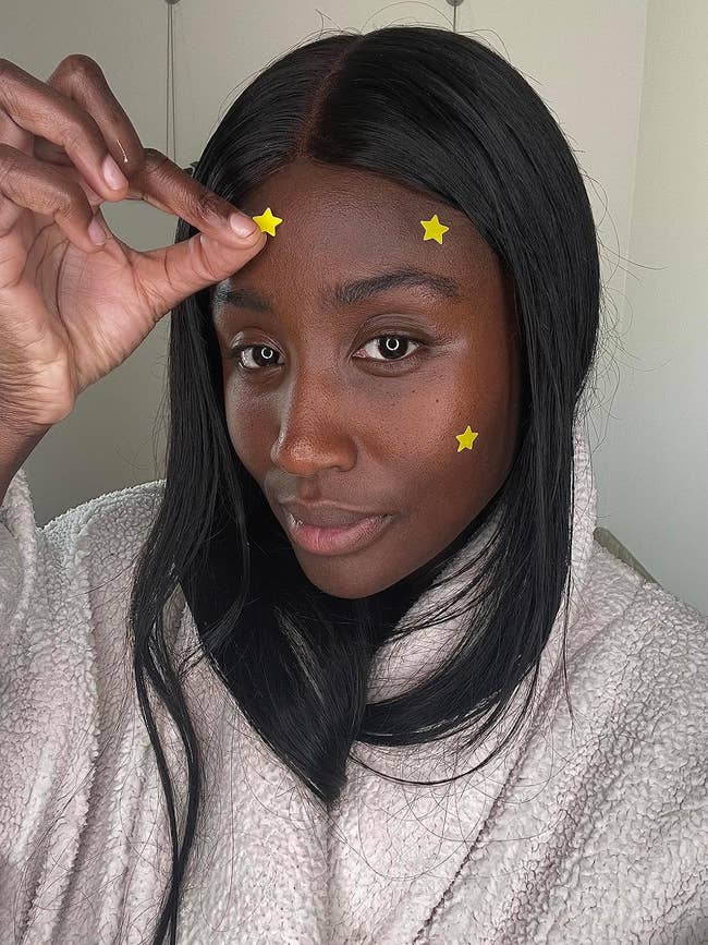 different reviewer wearing some of the yellow star faced pimple patches on their face