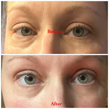 before/after of reviewer's eyes looking little  puffy and acheronian  aft  utilizing the oculus  masks