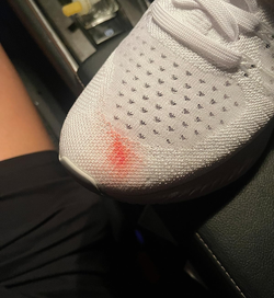 A reviewer's white shoe with a red stain on the toe 