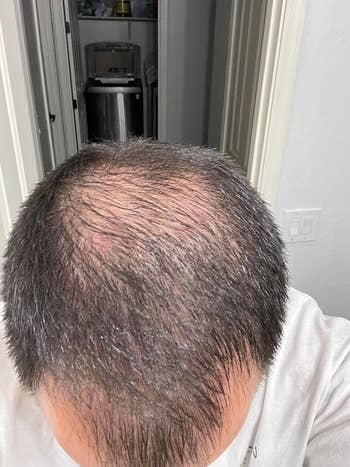 head before and after using serum