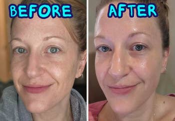 Before and aft close-up images of a woman's look showing a skincare translation with smoother, glowing skin