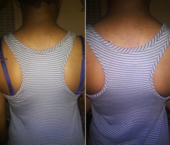 Reviewer with bra straps peeking out beneath shirt before putting on the bra strap clip and bra straps being hidden after putting on the clip