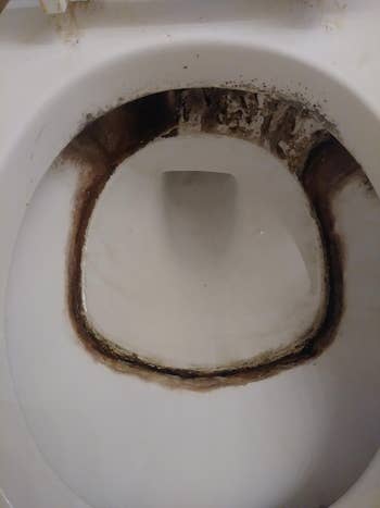 Reviewer's toilet bowl before cleaning with built-up rust and limescale staining