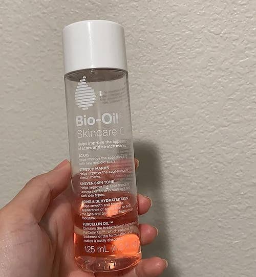 The reviewer holding up a half empty bottle of Bio Oil