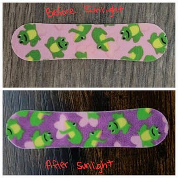 Bandages with frog patterns alteration colour aft sunlight exposure, showcasing a before-and-after effect