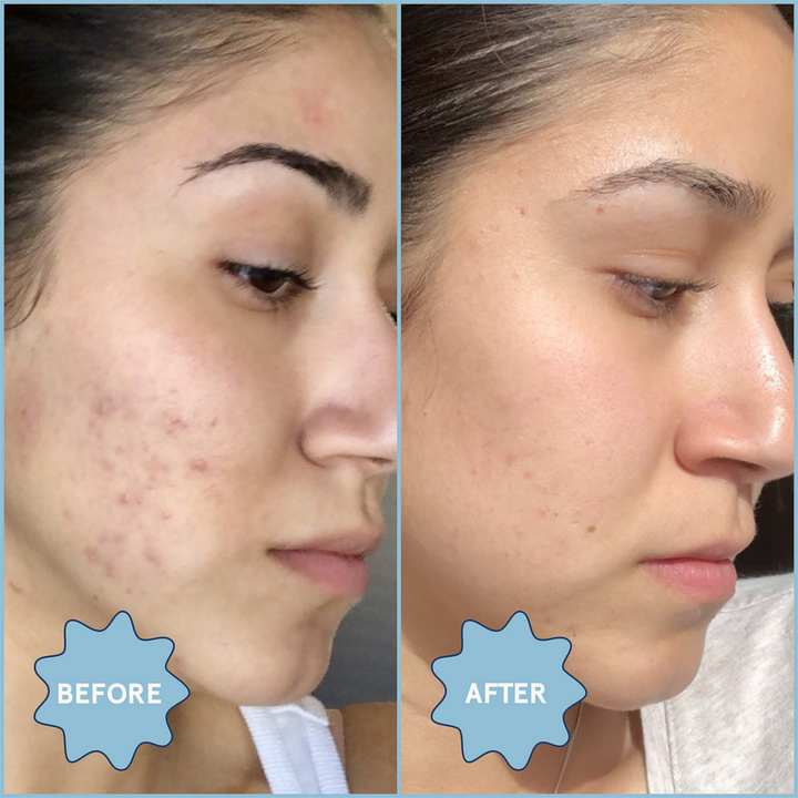 A before and after of someone using the Blume Meltdown Oil