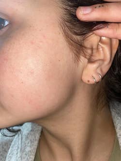 Same reviewer with much smoother and hairless skin after using the tool