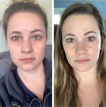 Another reviewer showing results of using CeraVe eye cream with brighter under eyes after