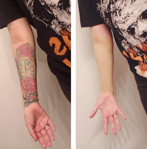 Reviewers tattoo and then the tattoo covered with foundation