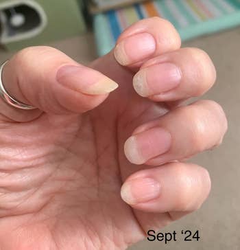 reviewer's manus  aft  utilizing nail cream