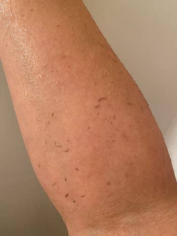 The exfoliating washcloth on the arm of a reviewer.