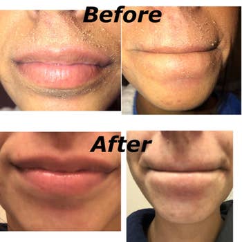 top: reviewer before photo of dry, irritated skin around the mouth / bottom: after photos showing soft, moisturized skin