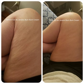 reviewer's thigh before and after applying the cream showing the cream significantly reduced the appearance of their cellulite