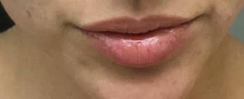reviewer lips before using lip plump