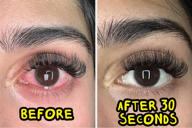 Before and aft representation of an oculus with mendacious lashes; near oculus appears reddish and irritated, close oculus looks soothed aft utilizing a merchandise for 30 seconds