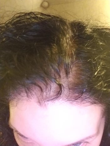 reviewer with thinning hair