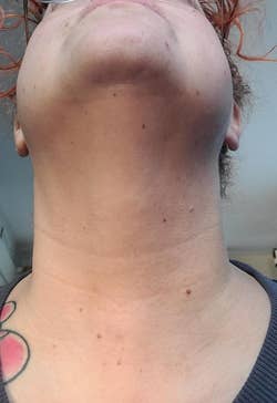 Close-up of a person's neck and chin with small moles and a tattoo partially visible