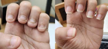 A reviewer short nails from nail-biting/The same reviewer with healthy-looking, longer nails