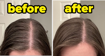 reviewer before and after pic of greasy hair made fresh again 