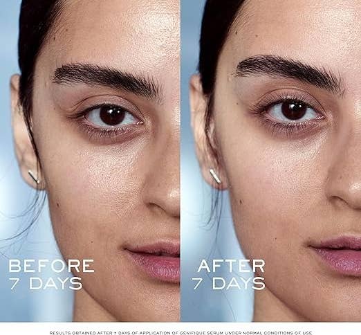 Split image comparing a model's face before and after skincare treatment over 7 days