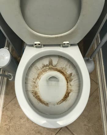 pengulas sebelum gambar bisul toilet yang bernoda