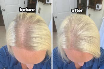 A before and after comparison of root touch-up coverage